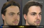 fifa15_headscan_krul_2.jpg